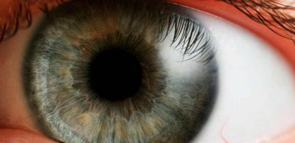 Tumores Intra-oculares: Causas e sintomas