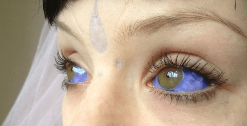 Quais os perigos das tatuagens oculares (na parte branca do olho)?