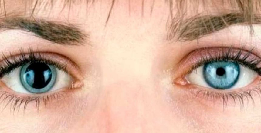 Simetria das pupilas e o diagnóstico de doenças oculares