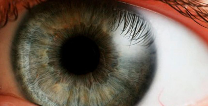 Tumores Intra-oculares: Causas e sintomas
